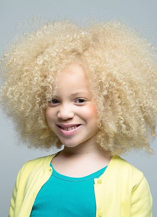 Are there any specific hair dyes recommended for people with albinism