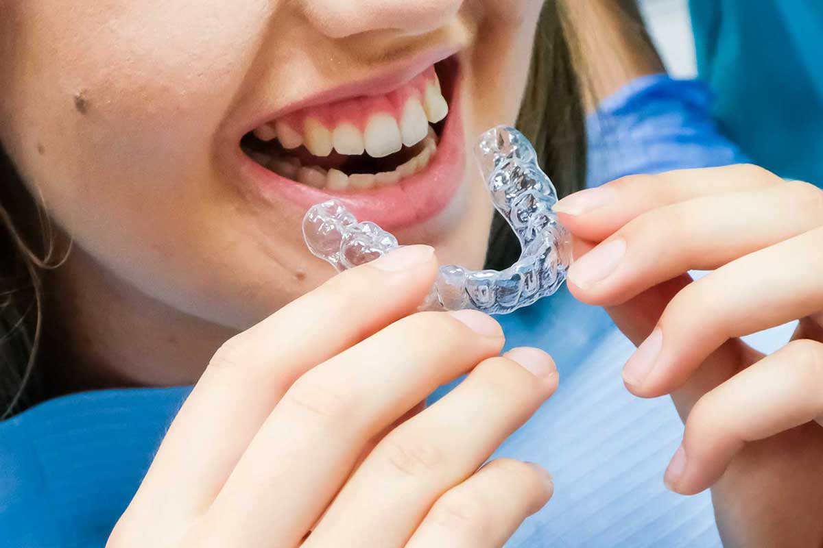 London's Clear Aligners: A Discreet Path to Straight Teeth