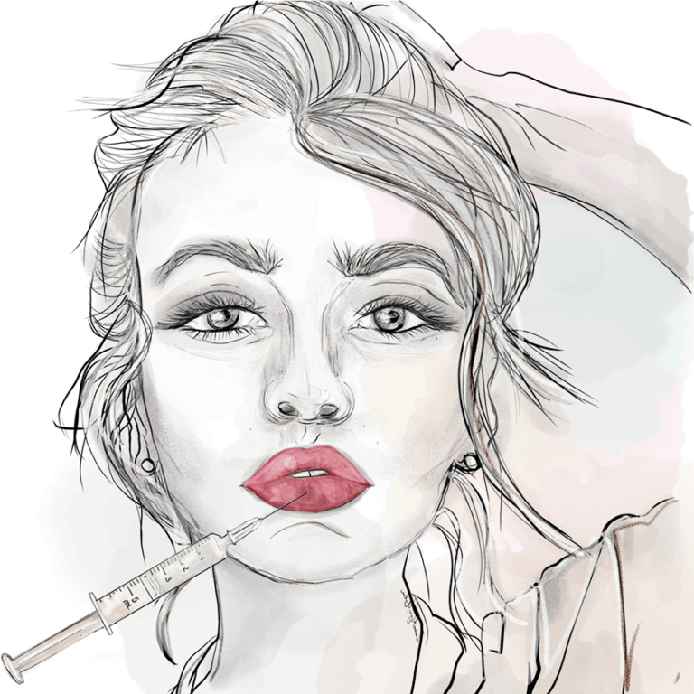 Dermapen Treatment in London
