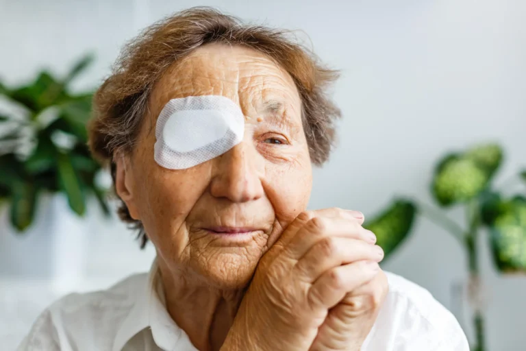 GERIATRICS Cataract Wellness and Prevention: Protecting Vision Throughout Aging