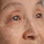 When Vision Starts to “Change”: Understanding Geriatric Cataract Symptoms and Conditions