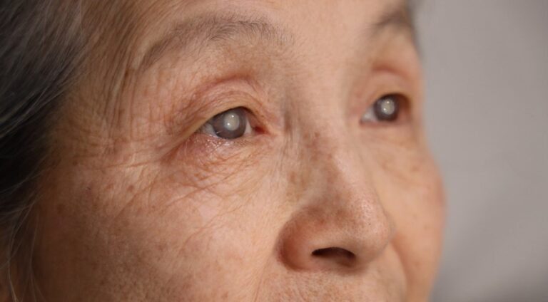 When Vision Starts to “Change”: Understanding Geriatric Cataract Symptoms and Conditions